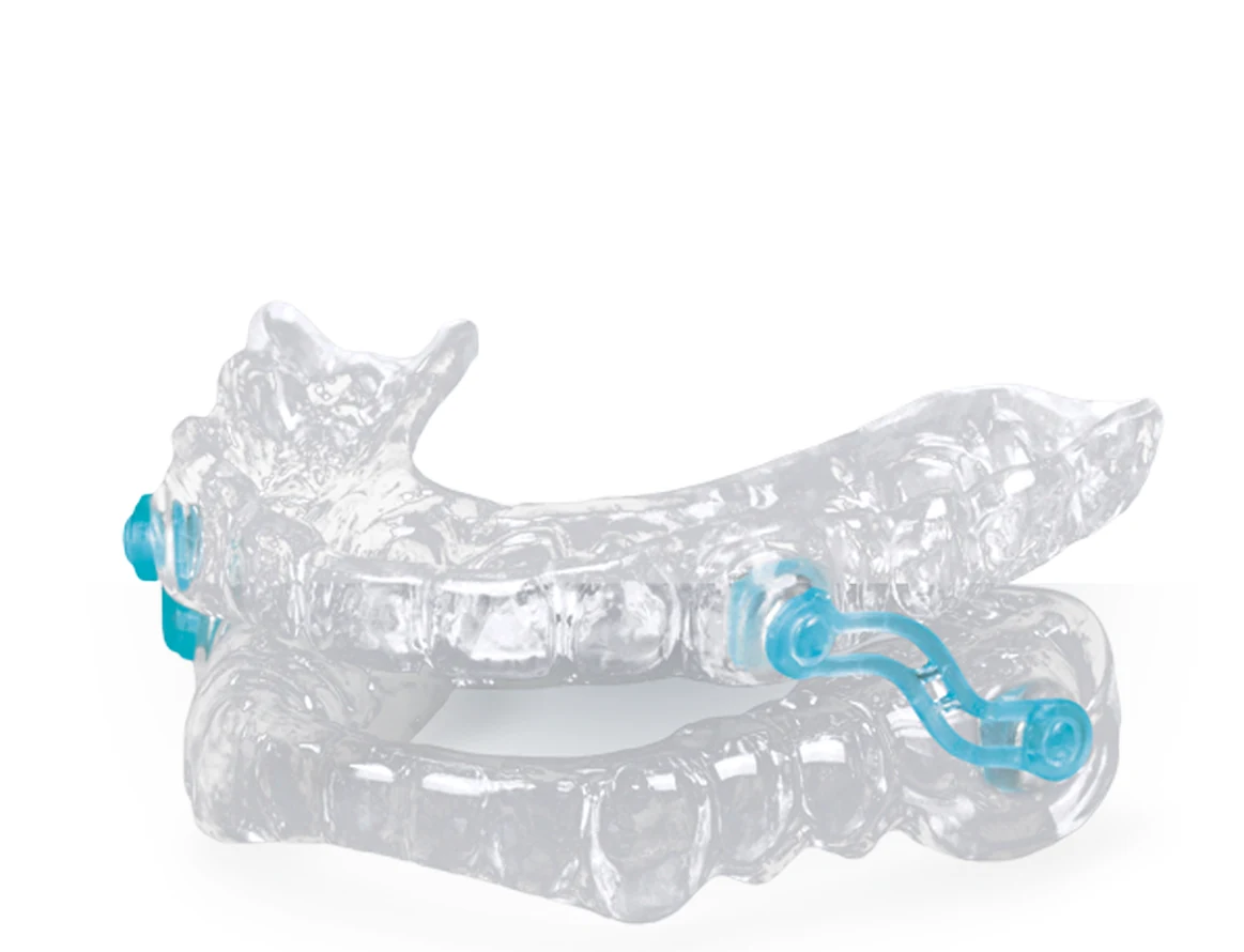 Aparelho intraoral de avanco mandibular usado no tratamento de ronco e apneia