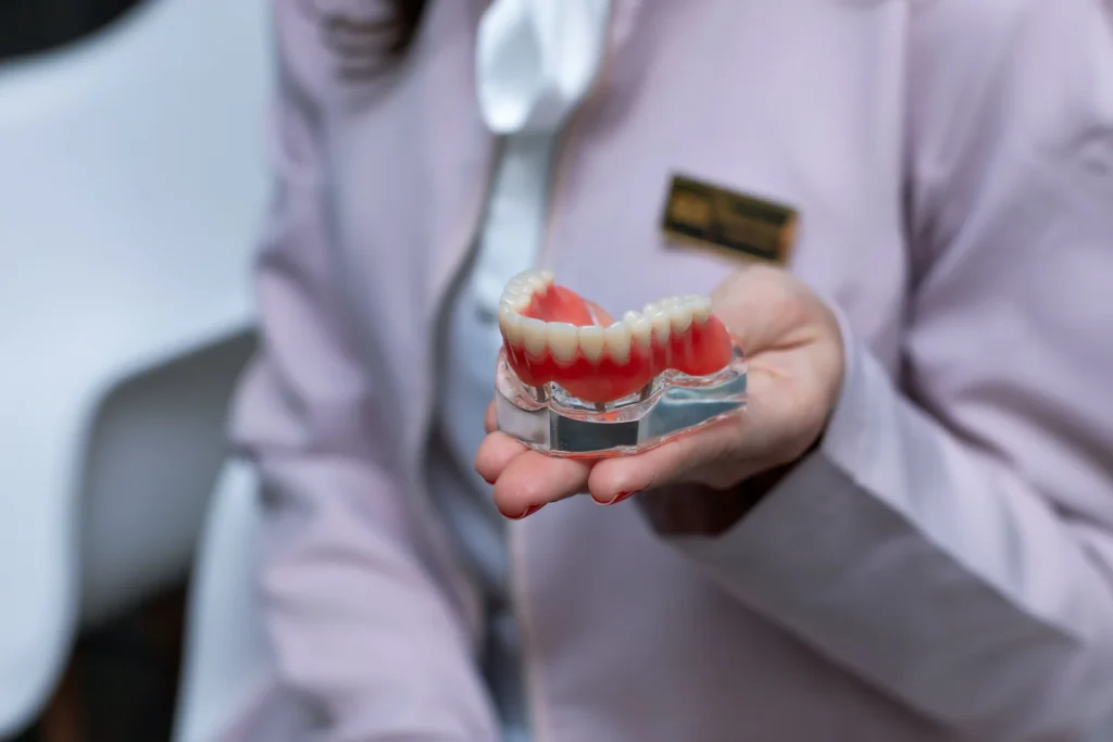 Dentista segurando modelo de arcada com implantes na palma da mao