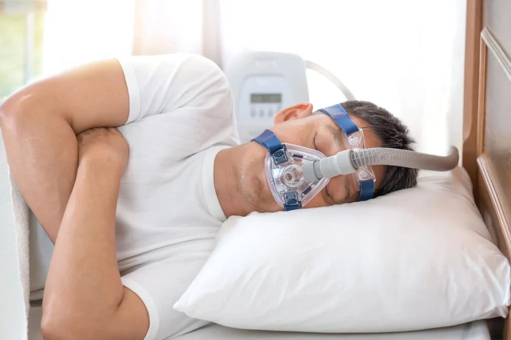 Paciente dormindo com mascara de CPAP conectada a aparelho de pressao positiva
