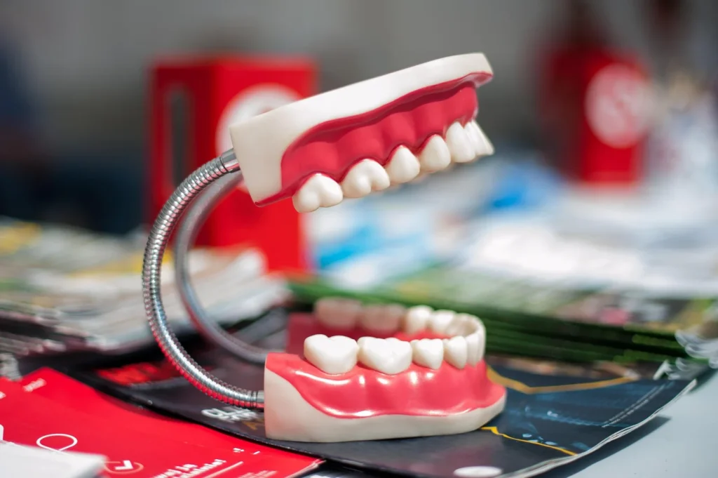 Modelo de arcada dentaria superior e inferior usado em demonstracao odontologica