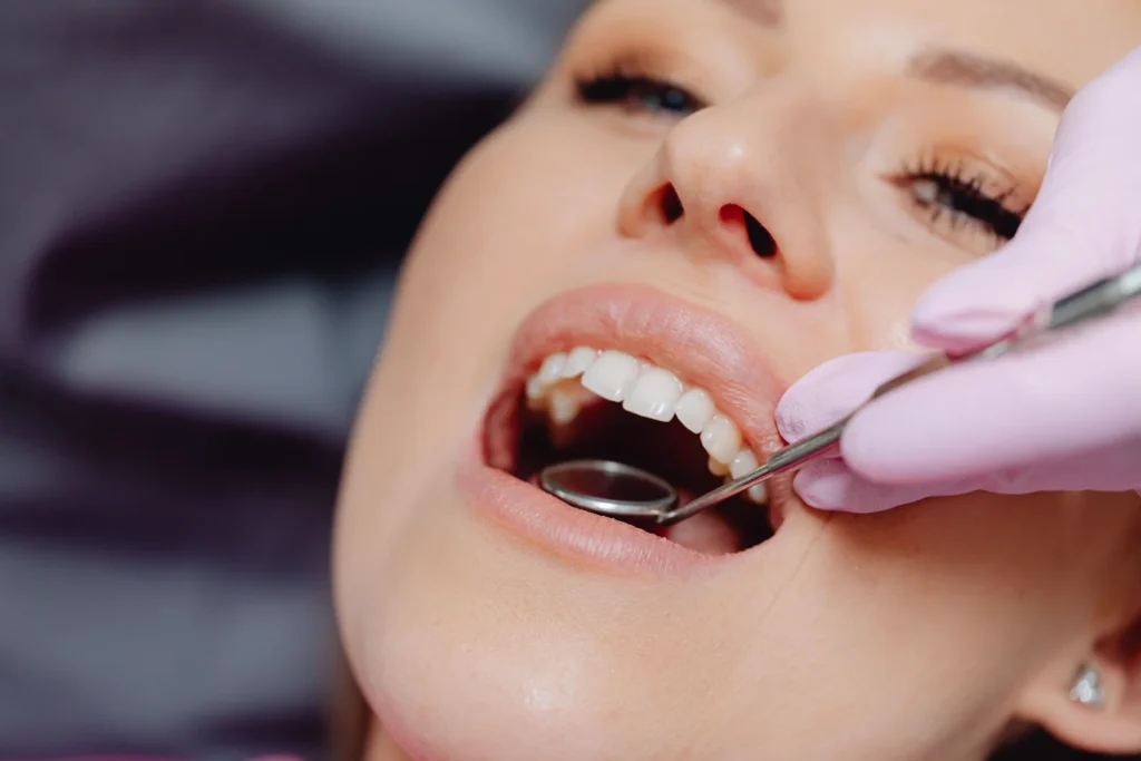 Exame odontologico com a boca aberta e instrumentos de avaliacao