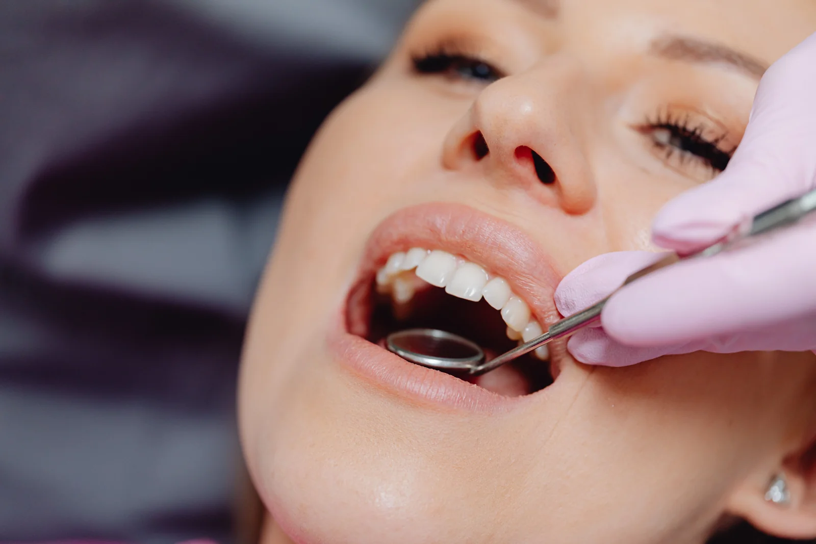 Exame odontologico com a boca aberta e instrumentos de avaliacao